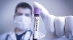 doctor con tubo de muestra de sangre que dice coronavirus
